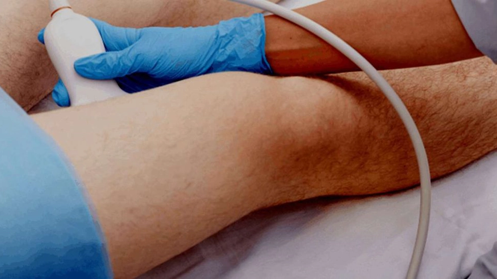 Ce preț are o ecografie doppler vasculară? Iată factorii care influențează costul investigației!