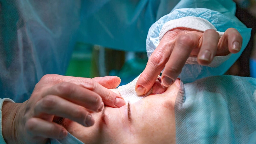 Ce preț are o rinoplastie? Iată care sunt factorii care influențează costul intervenției!