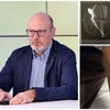 Nephrois – Clinca de Nefrologie Iasi condusă de medicul ieșean Adrian Covic a salvat accesul pentru dializă al unui pacient