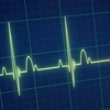 „Fenomenul Lazăr” zguduie lumea medicală! Un bărbat declarat mort s-a trezit după 30 de minute
