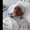 Tumoră cerebrală de 10 cm extirpată cu succes la Iași! Pacientul s-a trezit vorbind și mișcându-se