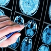 Studiu tulburător: pandemia a accelerat îmbătrânirea creierului! Cine e cel mai afectat
