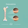 Laboratoarele Praxis: Osteocalcina – analiza care oferă informații esențiale despre sănătatea oaselor