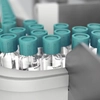A apărut vaccinul împotriva hantavirusului! Primele doze au fost trimise în țările afectate!
