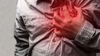 De ce este periculoasă fibrilația atrială? Află dacă este o cauză pentru accidentul vascular cerebral!