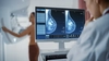 Descoperire revoluționară împotriva cancerului de sân! Un nou medicament reduce la jumătate riscul de progresie sau deces