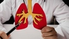 Embolia pulmonară se vindecă? Iată care este adevărul și ce trebuie să știi despre opțiunile de tratament