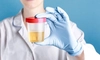 Ce afli dintr-un sumar de urină și urocultură și care este prețul, de fapt? Două analize care pot preveni complicații grave!