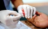 Un nou medicament cu potențialul de a „pune capăt pandemiei de HIV” urmează să fie lansat