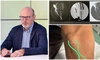 Nephrois – Clinca de Nefrologie Iasi condusă de medicul ieșean Adrian Covic a salvat accesul pentru dializă al unui pacient