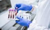 Pot analizele de sânge să depisteze scleroza multiplă? Iată ce trebuie să știi pentru diagnostic
