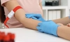 Aceasta este lista analizelor gratuite, după vârsta de 40 de ani! Puțini români știu aceste beneficii