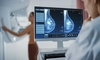 Descoperire revoluționară împotriva cancerului de sân! Un nou medicament reduce la jumătate riscul de progresie sau deces