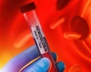 Hemoglobina mică și cancerul, ce legătură există între ele? Iată ce trebuie să știi!