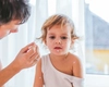 Ce remedii calmează mâncărimea la varicelă? Află de ce adulții fac forme mai severe!