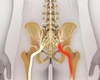 Unde se află nervul sciatic? Află tot ce trebuie să știi despre acesta