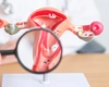 Cancerul de endometru, simptome adeseori ignorate! Află în ce constă tratamentul!
