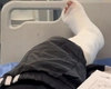 De la Loft a ajuns direct la spital! Bettyshor a reușit să își rupă piciorul în mini-vacanța de 1 Mai