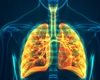 Care sunt cele mai grave boli de plămâni? Iată care sunt simptomele, cauzele și formele severe
