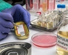 Care sunt primele semne de botulism? Iată simptomele care necesită măsuri urgente!