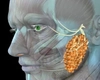 Ce simptome există la cancerul glandei parotide? Iată semnele care nu trebuie ignorate