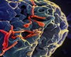 Alertă medicală în Europa! O boală mortală și extrem de contagioasă face ravagii