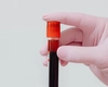 Ce simptome apar atunci când ai leucocite mari? Infecție sezonieră sau afecțiune cronică?