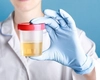 Ce afli dintr-un sumar de urină și urocultură și care este prețul, de fapt? Două analize care pot preveni complicații grave!