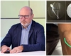 Nephrois – Clinca de Nefrologie Iasi condusă de medicul ieșean Adrian Covic a salvat accesul pentru dializă al unui pacient