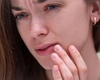 Ai buzele umflate din senin? Iată care pot fi cauzele, riscurile și soluțiile