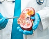 Ai creatinina serică mare? Iată care sunt cauzele, simptomele și cum poți să o scazi