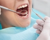 Fals dentist de 22 de ani trata pacienți în apartamentul familiei, cu ajutorul părinților. Tânărul a câștigat o sumă uriașă de bani