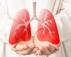Care sunt cauzele care duc la un tromboembolism pulmonar? Este o urgență medicală care pune viața în pericol!