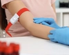 Aceasta este lista analizelor gratuite, după vârsta de 40 de ani! Puțini români știu aceste beneficii