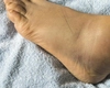 Ai o singură gleznă umflată? Iată care pot fi cauzele și ce opțiuni de tratament există
