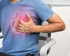 Ce pastile să iei când suferi de angină pectorală. Opțiuni de tratament pentru combaterea durerii