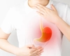Schemă completă de tratament pentru refluxul gastroesofagian – Iată tot ce trebuie să știi pentru a aborda eficient această afecțiune