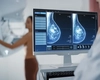 Descoperire revoluționară împotriva cancerului de sân! Un nou medicament reduce la jumătate riscul de progresie sau deces