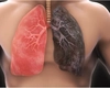 Alimente care cresc riscul de a avea cancer la plămâni. Iată studiul care arată legătura dintre dieta și boală