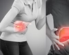 Cancerul de ficat se vindecă? Iată ce simptome există și cum se tratează!