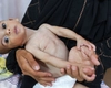 Locuitorii din Gaza mor de foame! Sunt „cadavre ambulante” pe măsură ce cazurile de malnutriție cresc, spune șeful UNRWA