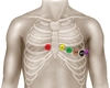 Ghid complet de poziționare electrozi EKG pentru o înregistrare corectă!