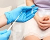 Ce înseamnă ureaplasma pozitiv? Află cum se tratează și care sunt riscurile nediagnosticării