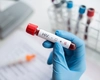 O injecție bianuală poate preveni HIV! UE aprobă medicamentul revoluționar