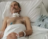 Un bărbat de 52 de ani, bolnav de cancer faringian, are nevoie de ajutor financiar pentru a se putea trata la Iași: „A ajuns într-un stadiu critic, fără voce”