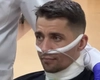 Un soldat ucrainean a supraviețuit miraculos după ce rușii i-au tăiat gâtul și l-au aruncat într-o groapă! “Ceea ce îl diferențiază este…”