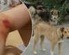 O copilă a fost mutilată de un câine maidanez, în Podu Iloaiei! Părinții se tem că incidentul s-ar putea repeta oricând: „E o teroare pentru toată lumea”