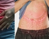 Cum scapi de balonare și gaze! Gastroenterologii susțin că așa vă simțiți mai bine în fiecare zi