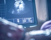 Doctorii nu puteau să creadă ce au văzut în timpul ecografiei. Dar când s-a născut bebelușa, farmecul, forța și povestea ei au atins inimile oamenilor din întreaga lume în cel mai neașteptat mod