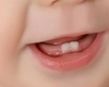 Erupția dentară la bebeluși – Iată tot ce trebuie să știi ca părinte despre această etapă
